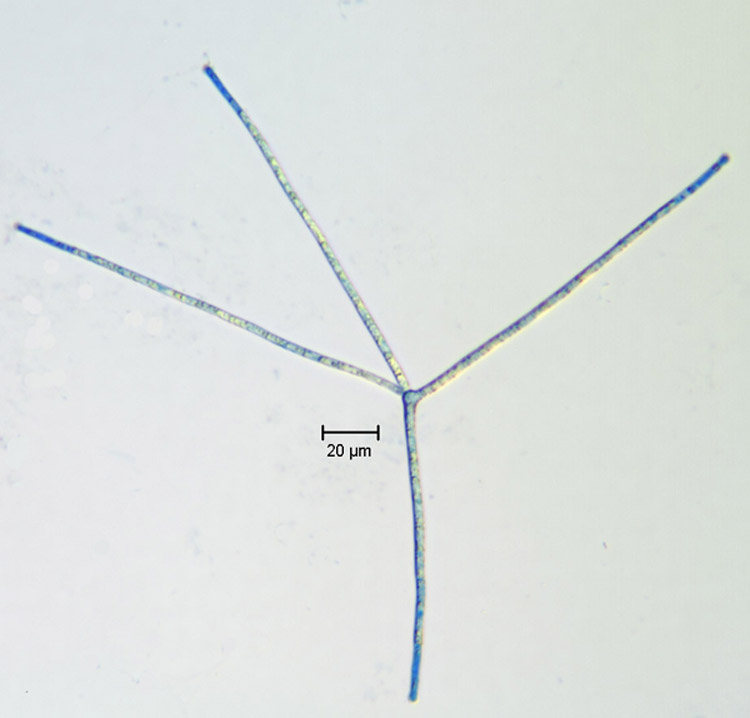 Tetrachaetum elegans