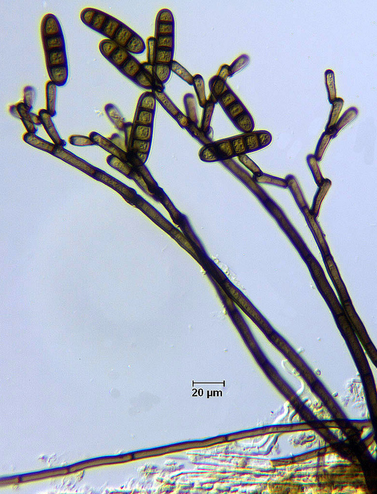 Dendryphiopsis atra