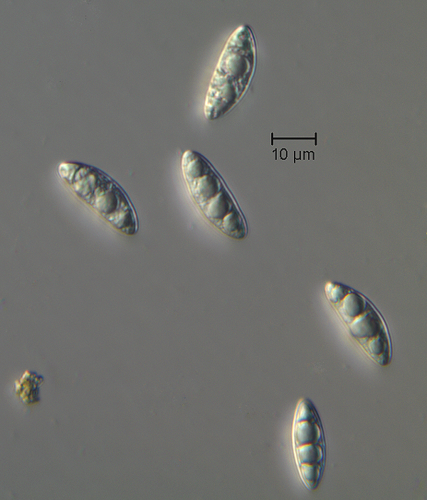A413_ascospore.jpg