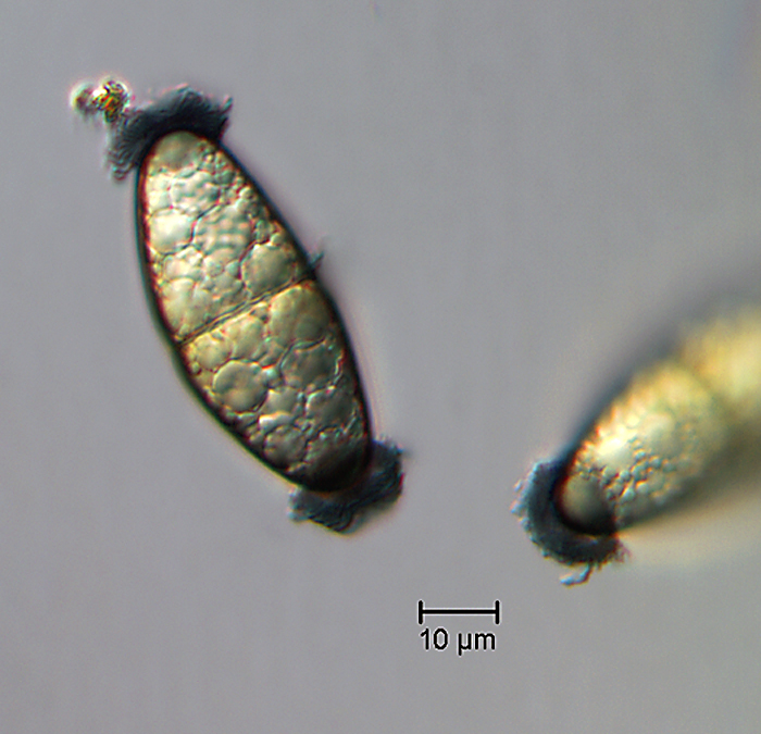 A421_ascospore.jpg