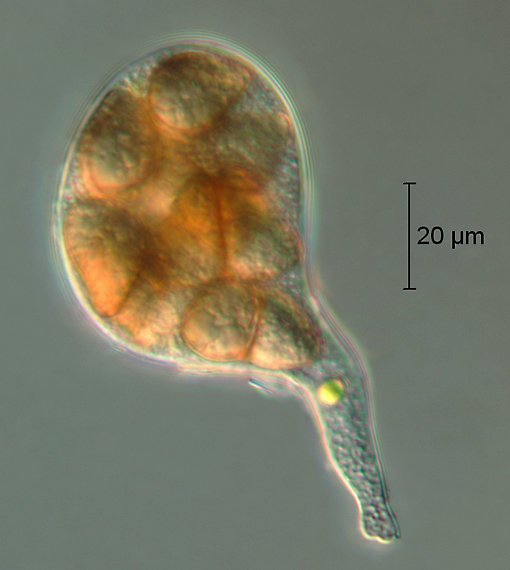 CS470_Ascus_12.jpg