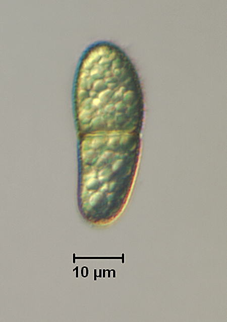 F004_Ascospore4.jpg