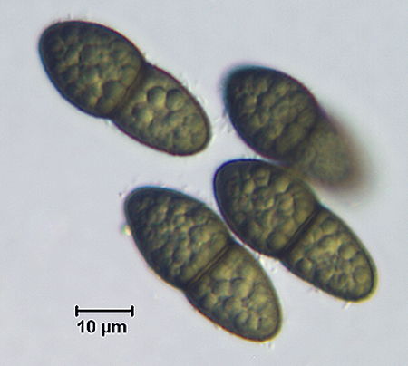 F004_Ascospores3.jpg