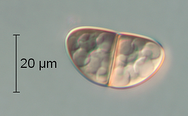 F118ascospore_2.jpg