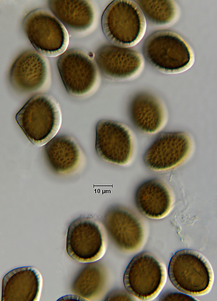 F24_Ascospore_3.jpg