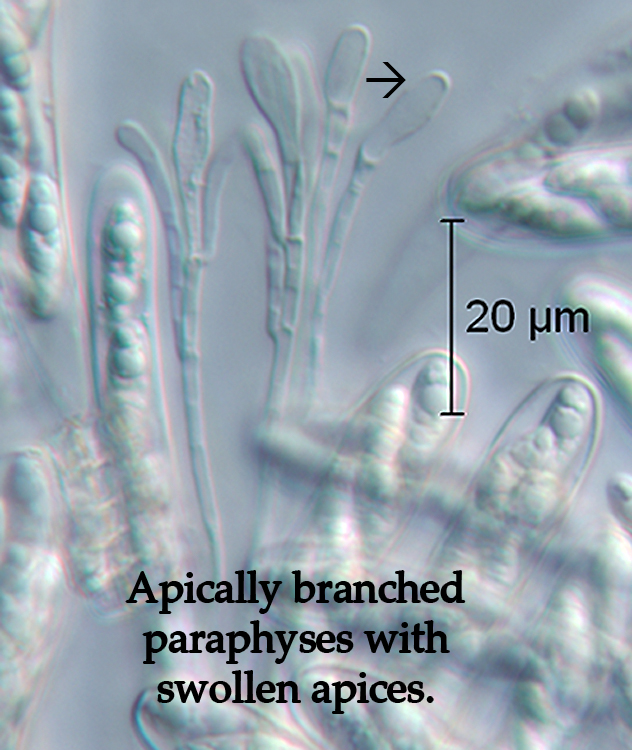 F47_physes_1T.jpg