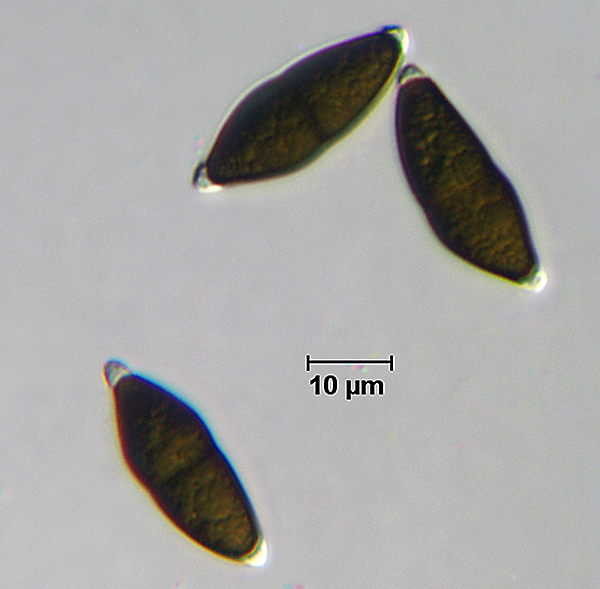 F49_Ascospore.jpg