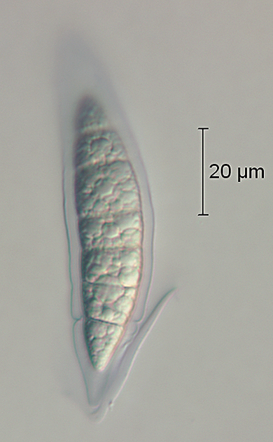 F88_Ascospore_10.jpg