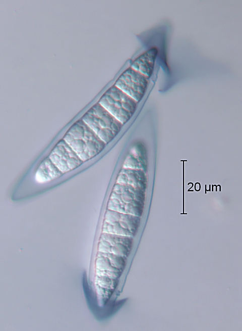 F88_Ascospore_5.jpg