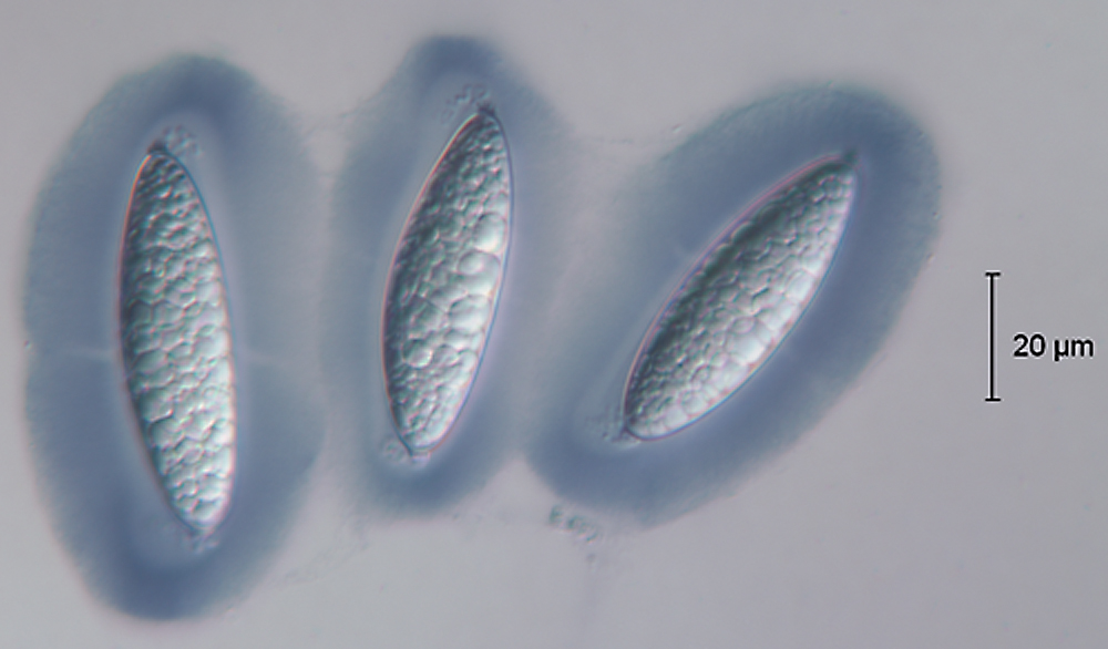F99_ANascospore1.jpg