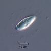 Fluviatispora reticulata - Sheath