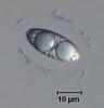 Fluviatispora reticulata - Ascospore