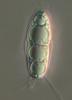 Wicklowia aquatica - Ascospore