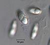 Fluviatispora reticulata - additional image