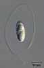 Fluviatispora reticulata - additional image