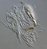 Wicklowia aquatica - Hamathecium