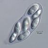 Fluviatispora reticulata - additional image