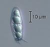 Wicklowia aquatica - Sheath