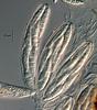 Falciformispora lignatilis - Ascus
