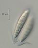 Falciformispora lignatilis - Appendage