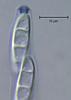 Cyanoannulus petersenii - additional image