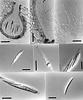 Pseudohalonectria lutea - additional image