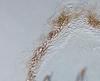 Hyalorostratum  brunneisporum  - Peridium
