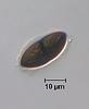 Hyalorostratum  brunneisporum  - Ascospore