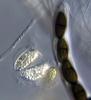 Hyalorostratum  brunneisporum  - additional image