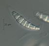 Falciformispora lignatilis - additional image