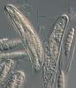 Falciformispora lignatilis - additional image