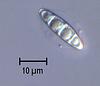 Cyanoannulus petersenii - Sheath