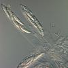 Falciformispora lignatilis - additional image