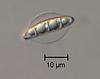 Cyanoannulus petersenii - additional image