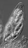 Aniptodera chesapeakensis - Ascus