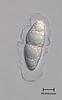 Lindgomyces cinctospora - additional image
