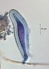 Falciformispora lignatilis - additional image