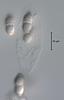 Nais inornata - Ascus