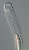 Falciformispora lignatilis - additional image