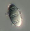 Luttrellia parvulospora - Sheath