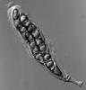 Kirschsteiniothelia elaterascus - Ascus
