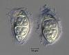 Luttrellia guttulata - Ascospore