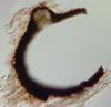 Luttrellia halonata - Ascomata