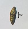 Jahnula aquatica - Ascospore