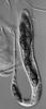 Kirschsteiniothelia elaterascus - additional image
