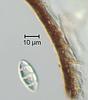 Luttrellia parvulospora - Peridium