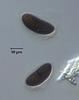Hyalorostratum  brunneisporum  - Sheath