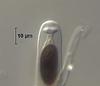 Hyalorostratum  brunneisporum  - additional image