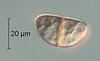 Lepidopterella tangerina - Ascospore