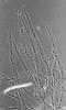 Ophioceras tenuisporum - Hamathecium